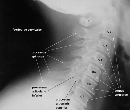 anatomia radiologiczna - vertebrae cervicales.jpg